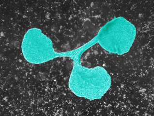 Trichoplax adhearens vermehrt sich größtenteils ungeschlechtlich, indem sich die Tiere in zwei Teile teilen. Diese Aufnahme zeigt eine seltene Dreiteilung.