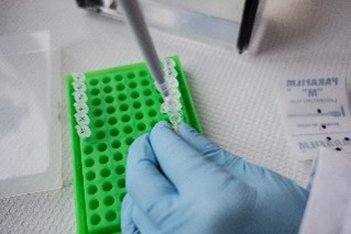 Pipettierarbeit