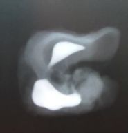 Left ear of a harbour porpoise in the decalcification phase