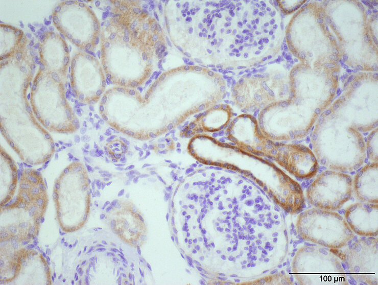 Immunohistochemische Bild