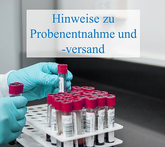 Aufnahme eines Ständers mit Probenröhrchen mit rotem Deckel sowie einer Person die mit blauen Latexhandschuhen Röhrchen in den Ständer stellt