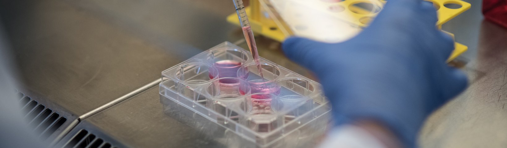 Probenbearbeitung Probe wird in Behältnis pipettiert