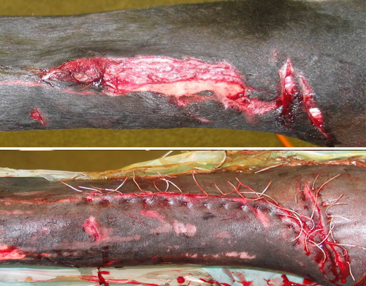 Verletzung vor und nach chirurgischer Versorgung