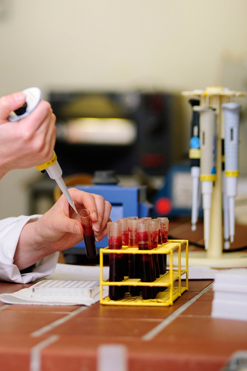 Blutprobenuntersuchung