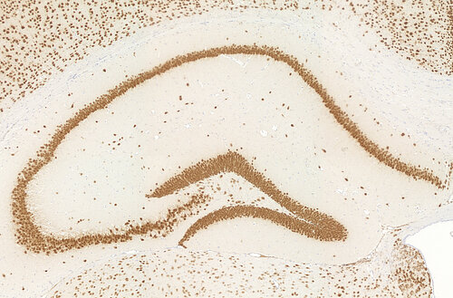 Der intakte Hippocampus einer transgenen Maus, deren Mikroglia-Funktion beeinträchtigt ist. Foto: Christopher Käufer