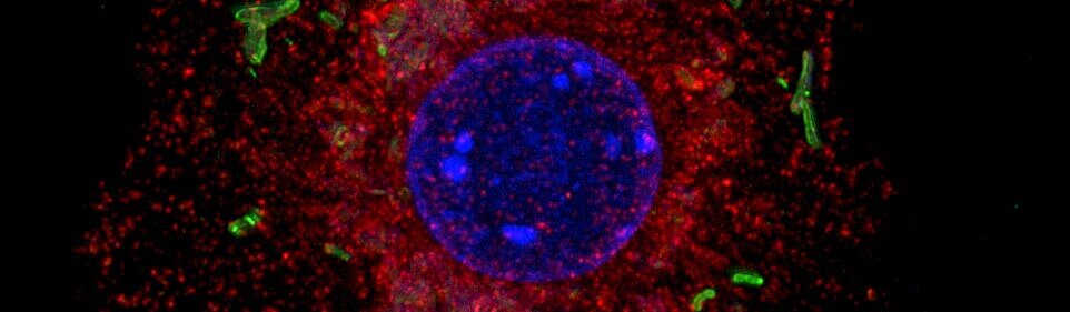 Makrophage mit Mykobakterien