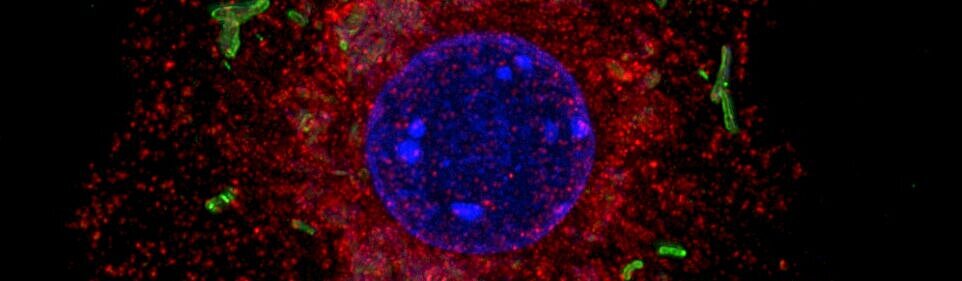 Makrophage mit Mykobakterien 