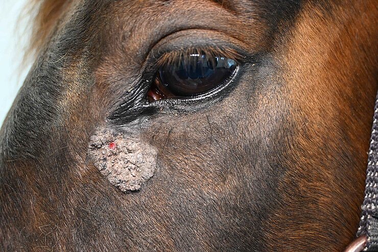 Bild eines Tumors unter dem Auge