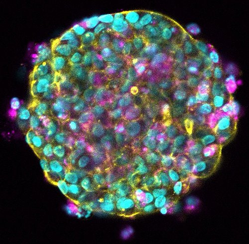 Organoid. Die Zellen sind angefärbt, um verschiedene Strukturen sichtbar zu machen.
