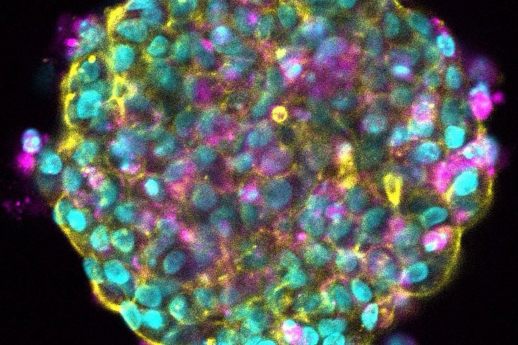 Organoid. Die Zellen sind angefärbt, um verschiedene Strukturen sichtbar zu machen.