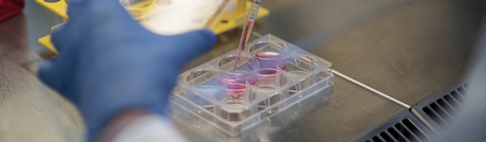Pipetterivorgang Zellkulturmedium in Lochplatte