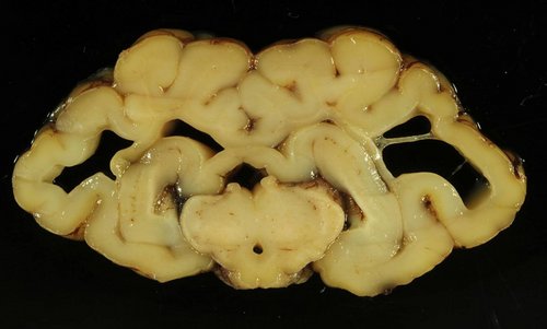PM130219_Schmallenbergvirus2.jpg