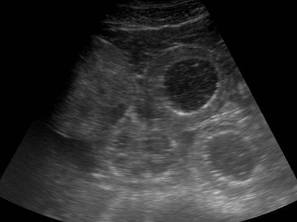 Ultraschalluntersuchung des Abdomen