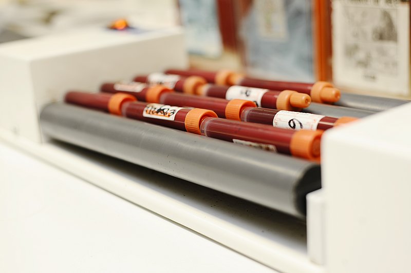 Blutproben zur Untersuchung in der Klinik für Rinder