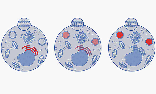 Verteilung der NPC1-Proteine (orange) in der Zelle: In Gruppe 1 befinden sich die Proteine nur im endoplasmatischen Retikulum (links). In Gruppe 2 befinden sie sich zusätzlich noch in den Lysosomen (Mitte). In Gruppe 3 zeigt das NPC1-Protein ein normales Verteilungsmuster in der Zelle (rechts). Abbildung: Molecular Sensei, Shutterstock.com