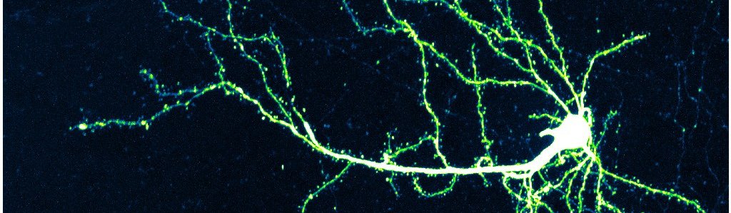 cortical neuron