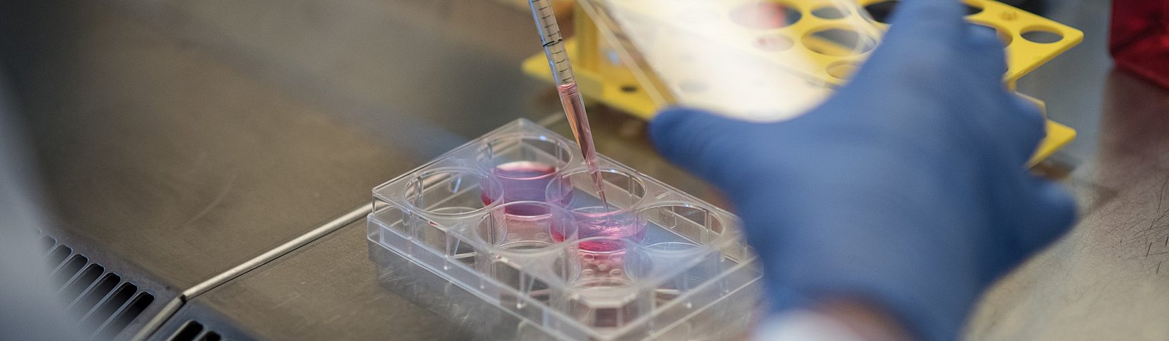 Zellmedium wird in Lochplatte mit Glaspipette eingefüllt 