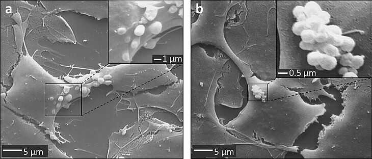 PM180925_Barrier_Bodies_REM.jpg