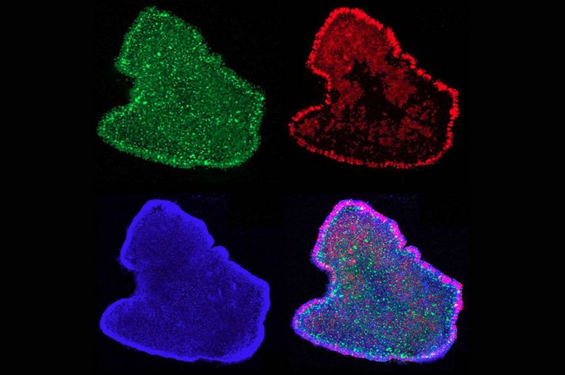 Antibody staining of cell proliferation in Trichoplax adhaerens Light microscopy antibody staining of cell proliferation proteins in Trichoplax adhaerens